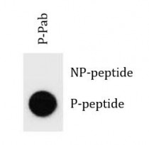anti-ERBB2 / HER2 phospho (Ser1107) antibody
