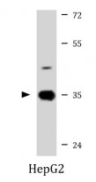 anti-ABT1 antibody
