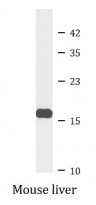 anti-eIF5A antibody
