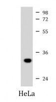 anti-CYB5R3 antibody