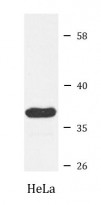 anti-MDH1 antibody
