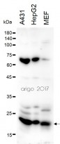anti-Proteasome 20S LMP2 antibody