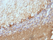 anti-Neurofilament NF-H (Phosphorylated) antibody [NE14]