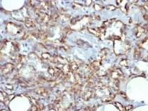 anti-CD31 antibody [JC/70A]
