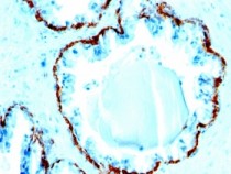 anti-basic Cytokeratin antibody [SPM591]