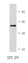 anti-HNMT antibody