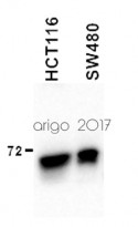 anti-hnRNP M antibody