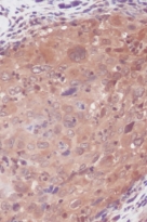 anti-IL6 antibody