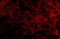 anti-IL33R / ST2 antibody