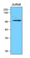 anti-Hexokinase 1 / 2 antibody [1A7]
