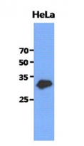 anti-GCLM antibody [2D12]