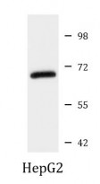 anti-ALP / Alkaline Phosphatase antibody