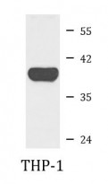 anti-FBP1 antibody
