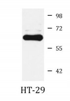 anti-ATIC antibody