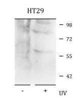 anti-CHEK1 phospho (Ser345) antibody