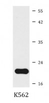 anti-DHFR antibody