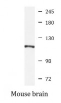 anti-alpha 2 Catenin antibody