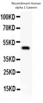 anti-alpha 1 Catenin antibody