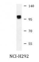 anti-NFATc1 antibody