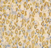 anti-Ephrin A1 antibody
