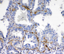 anti-VEGFD antibody
