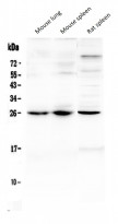 anti-TREM1 antibody