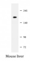 anti-NCOA2 antibody