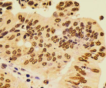 anti-SOX5 antibody