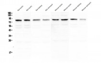 anti-POLI / DNA Polymerase Iota antibody