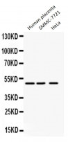anti-ANGPTL4 antibody