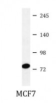 anti-ABCB10 antibody