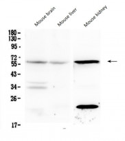 anti-IL23 Receptor antibody
