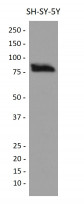 anti-SMURF2 antibody