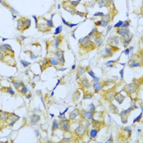 anti-TGFBR2 / TGF beta Receptor II antibody
