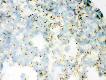 anti-SFTPA1 + SFTPA2 antibody