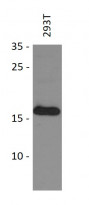 anti-GEMIN6 antibody