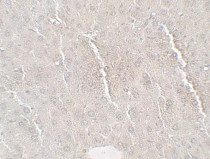 anti-Betatrophin antibody