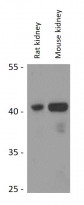 anti-APOBEC 3D antibody