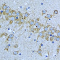 anti-EIF2AK4 / GCN2 antibody