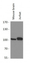 anti-MYSM1 antibody