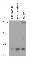 anti-RPIA antibody
