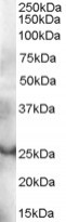 anti-GRAP antibody