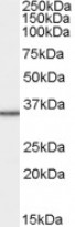 anti-MRPL3 antibody