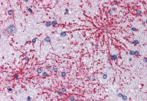 anti-BAIAP2 antibody
