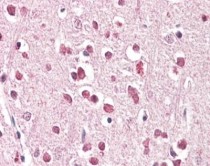 anti-XAB2 / HCNP antibody