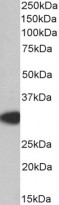 anti-MyD88 antibody