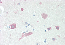 anti-Neuroserpin antibody