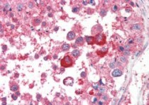 anti-B5 Receptor / PCID1 / EIF3M antibody