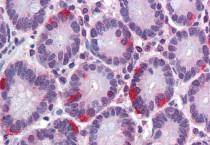 anti-SAR1 antibody