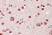 anti-STK39 / SPAK antibody